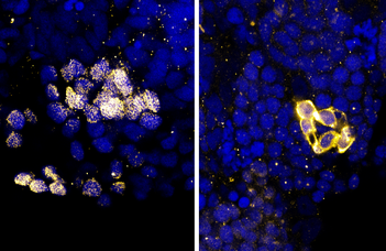 Fish and humans: a new approach to Bloom syndrome research